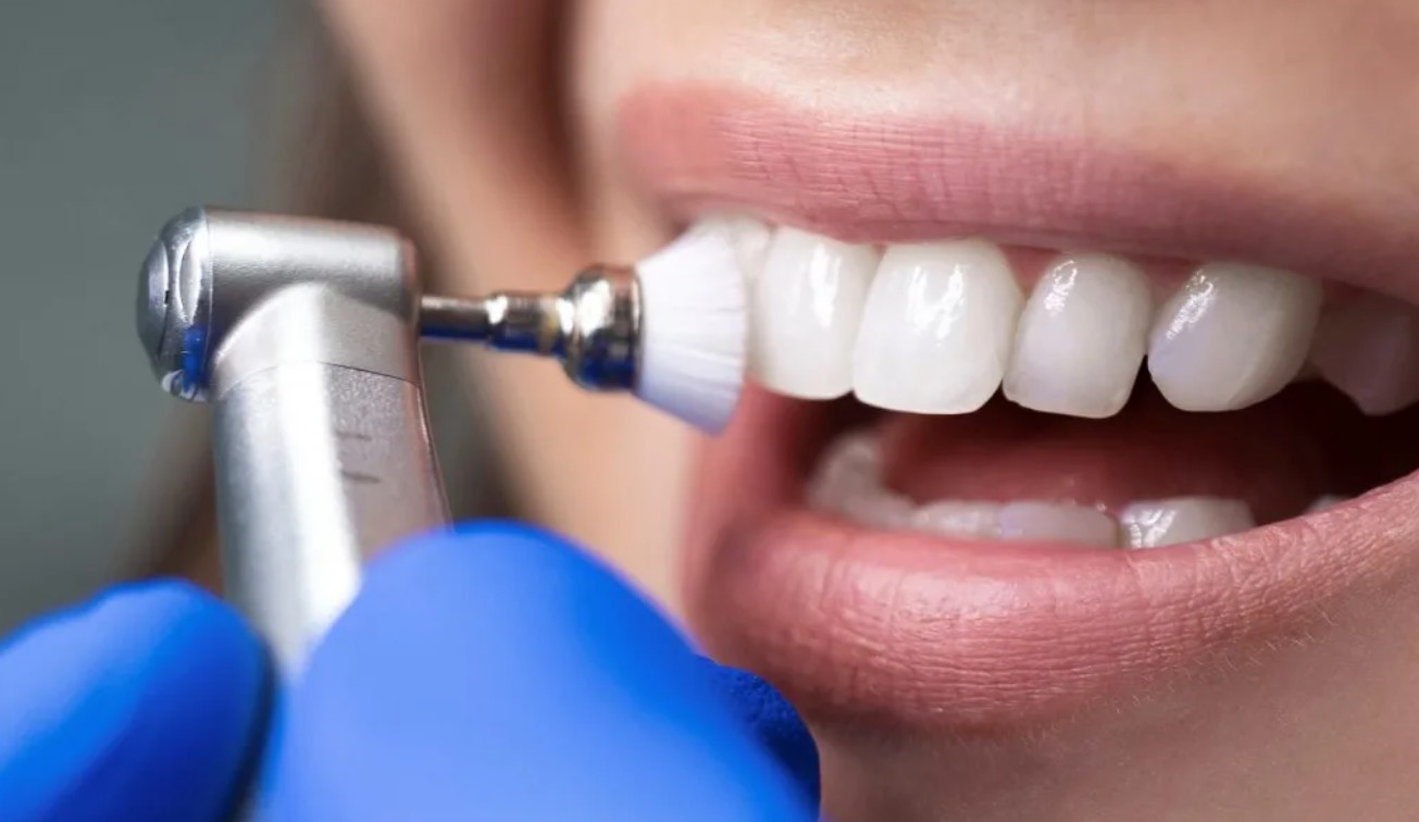 До 20 февраля в клинике "Здоровье+" действует скидка на гигиеническую чистку зубов