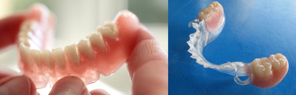 Зубные протезы Акри-Фри (Acry-Free)